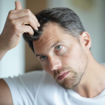 تقویت کننده موی مردانه